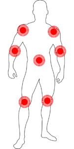 width=100