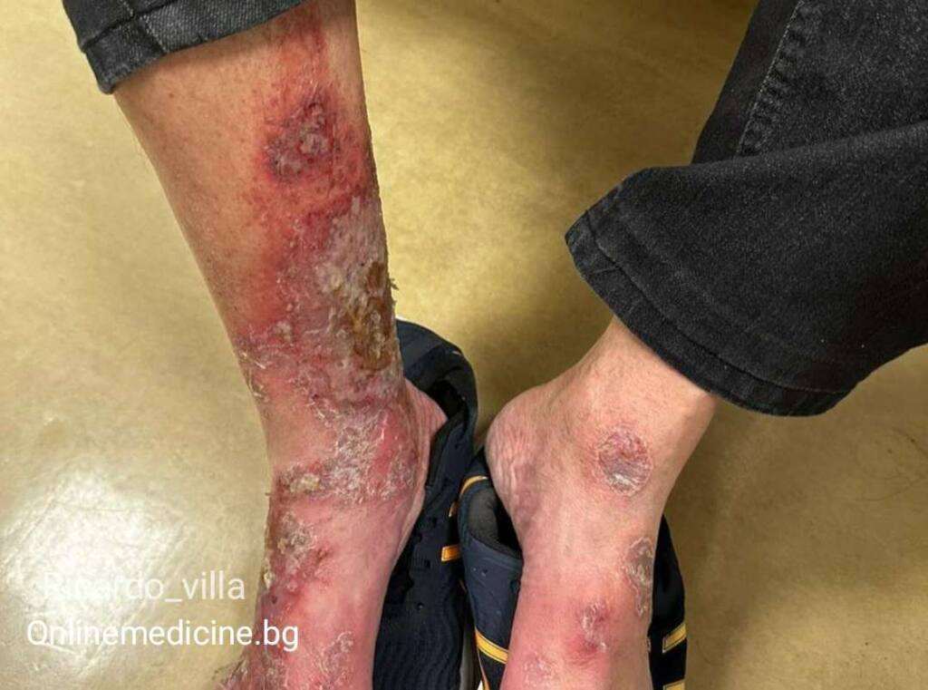 Dermatologichen