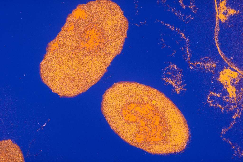 bordetella